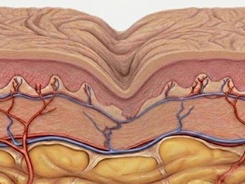 피부 구조의 붕괴