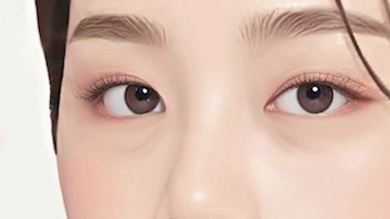 눈밑고랑주름재생주사