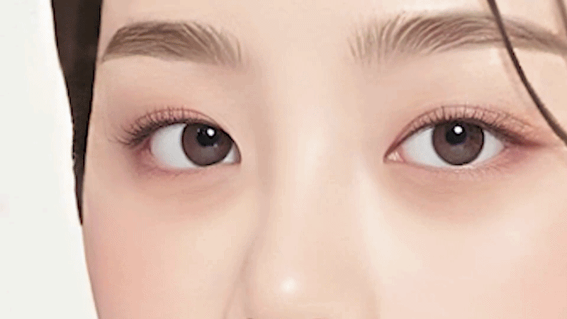 눈밑고랑주름재생주사