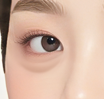 눈가 이미지